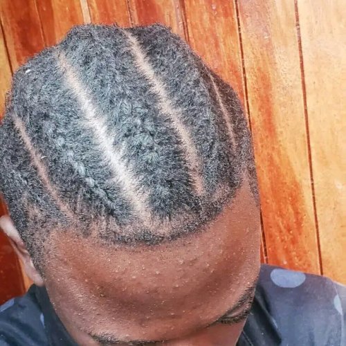 mack strikes x15 ft xnox